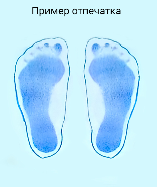 Плантограф ТАГЛЕР для определения плоскостопия фото2