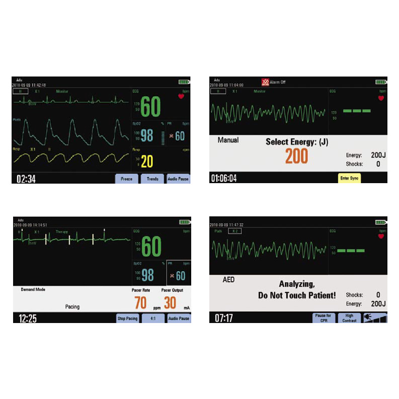 Дефибриллятор-монитор Mindray BeneHeart D3 с функцией электрокардиостимуляции фото2