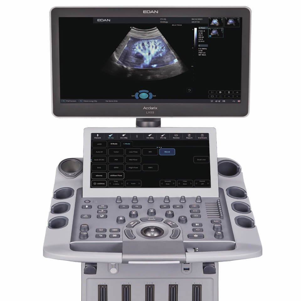 Диагностическая ультразвуковая система EDAN Acclarix LX85 фото2