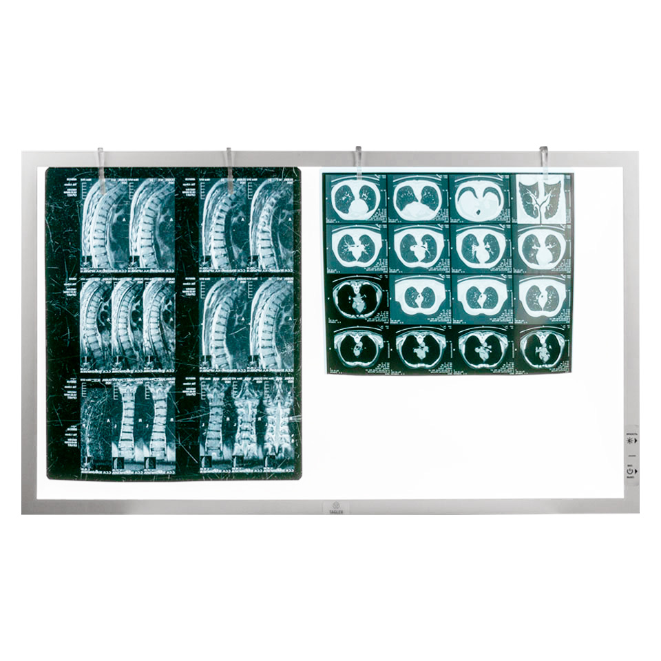 Двухкадровый медицинский светодиодный негатоскоп ТАГЛЕР НСД-2 фото3