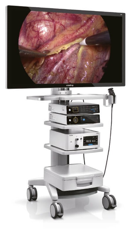 Видеоэндоскопическая система Minday HyPixel U1 (4K)