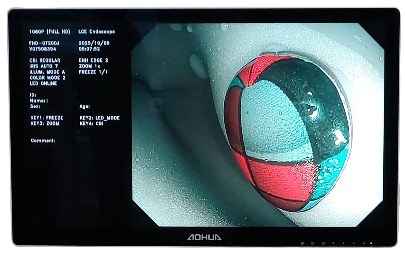Видеоэндоскопическая система Aohua AQ-200 фото9 Видеоэндоскопическая система Aohua AQ-200 фото9
