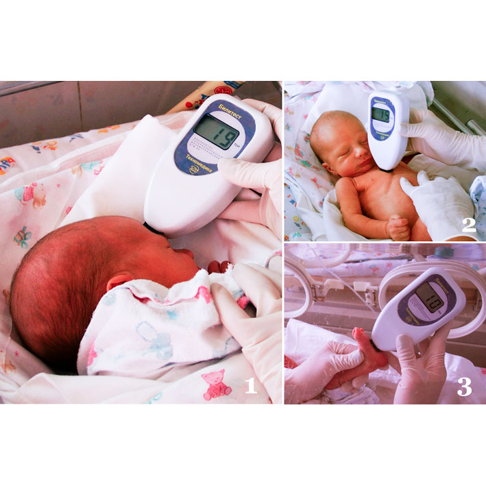 Транскутанный фотометрический анализатор гипербилирубинемии новорождённых Техномедика Билитест АГФ-02 фото2