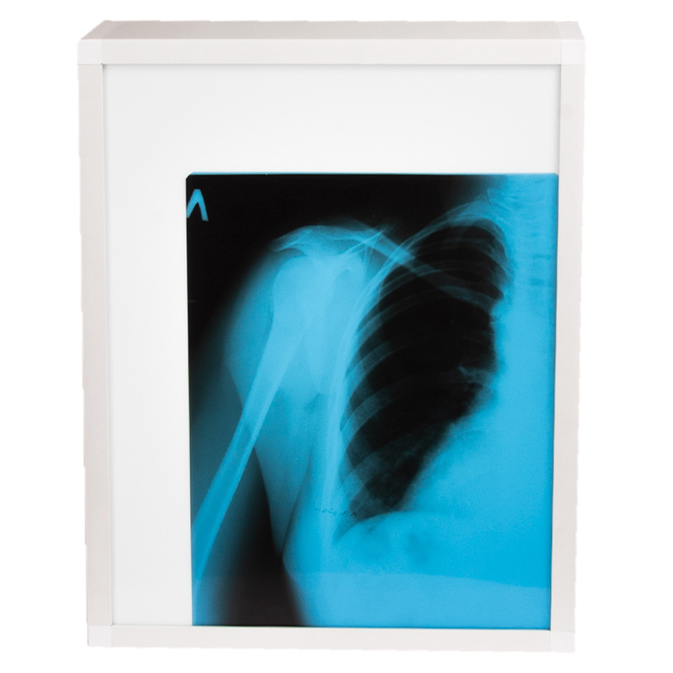 Однокадровый люминесцентный негатоскоп ТАГЛЕР НЛ-1 фото3